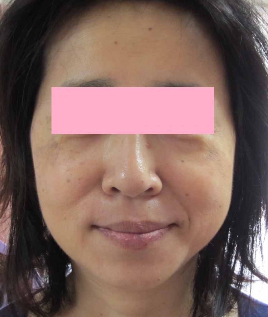 徳島で 女性の薄毛 白髪のお悩み頭皮ケアといえばａｒｏｏｎ